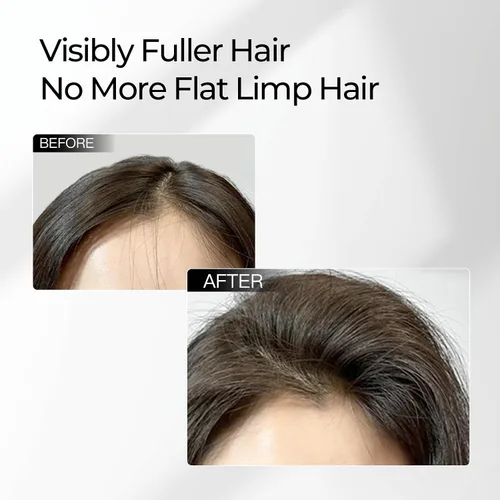 Vista 4 de Champú anticaída de cabello, cuidado del cuero cabelludo con botánicos naturales, tratamiento de terapia del cuero cabelludo para hombres y mujeres