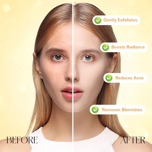 Vista 3 de Gel exfoliante de enzima naranja de 3 x 3.4 fl oz, limpiador profundo de poros y apriete facial, exfoliante suave de naranja para todo