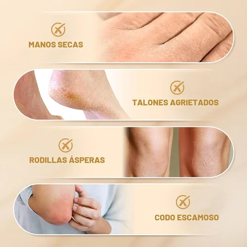 Vista 6 de 60% Crema de Urea con 2% Ácido Salicílico, Crema de Urea 60 Por Ciento para Pies y Manos - Hidratante de Fuerza Máxima para Piel Áspera, Seca