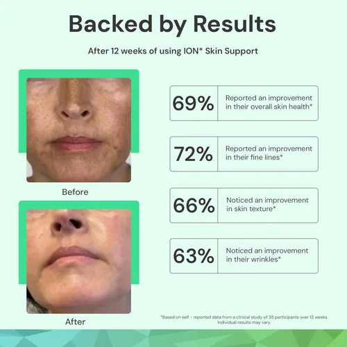 Vista 5 de ION* Intelligence of Nature Skin Support Face Mist - Spray hidratante para uso diario, tamaño de viaje, fórmula vegana para mujeres y hombres, 3.4