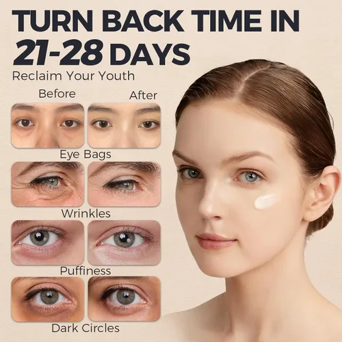 Vista 4 de Crema de retinol para debajo de los ojos – Crema de ojos antienvejecimiento para hinchazón y bolsas debajo de los ojos y arrugas, reafirmante e
