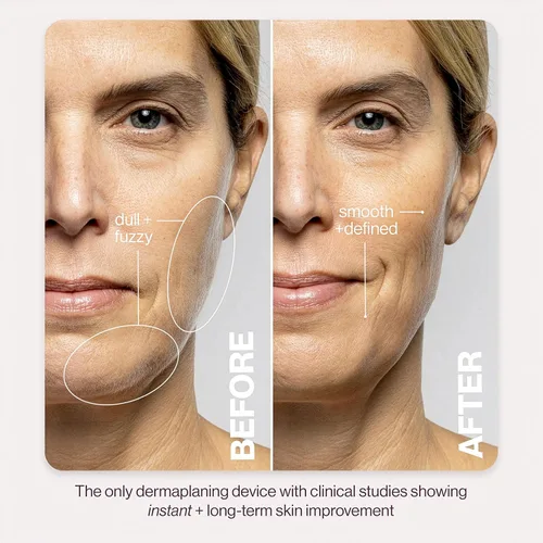 Vista 6 de DERMAFLASH LUXE+ Sonic Dermaplaning Tool for Face Peach Fuzz Removal, Anti-Aging and Exfoliation