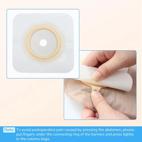 Vista 6 de 10 piezas de barrera cutánea con borde no tejido para bolsas de colostomía de dos piezas, corte a medida, 60 mm máx. – Barrera cutánea plana para un