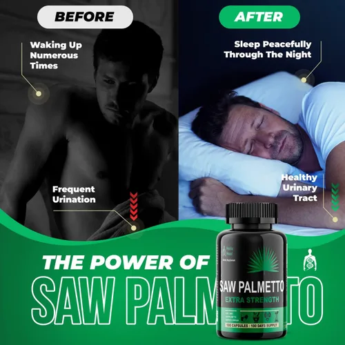 Vista 4 de Saw Palmetto para hombres – Suplementos para la salud de la próstata para hombres Salud urinaria – Bloqueador natural de DHT, 500 mg tratamientos