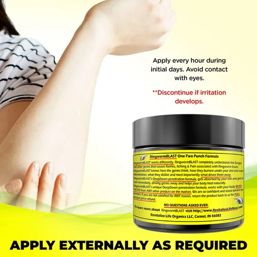 Vista 5 de Alivio de la tiña Crema Rápida Ungüento Dermatólogo y Probado en Laboratorio Mejor Que El Champú Adultos y Niños Natural Extra Fuerza Sin Parabenos