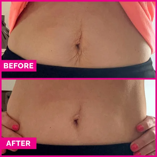 Vista 6 de Crema reafirmante para el estómago Tummy Sleek - Suero para tensar la piel para el vientre - Ayuda a mejorar la apariencia de la piel suelta