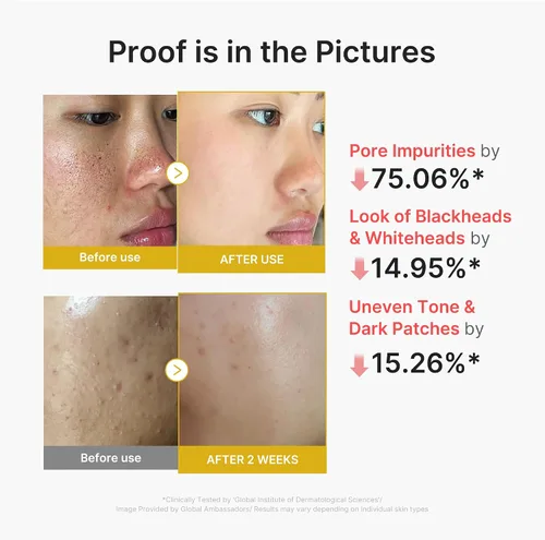 Vista 5 de medicube Dual Peel Shot Exfoliating Duo: Acido hipocloroso y cúrcuma Facial Peel Shots Cuidado específico de poros, exceso de sebo y textura