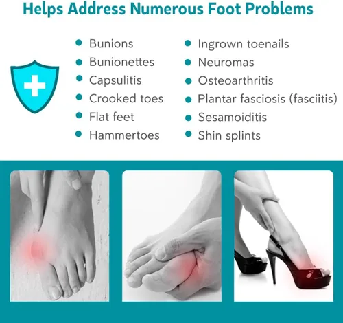 Vista 2 de 2 pares de separadores de dedos de los pies correctores de juanetes para mujeres/hombres, alineación de pies, esparcidores para juanetes, hallux