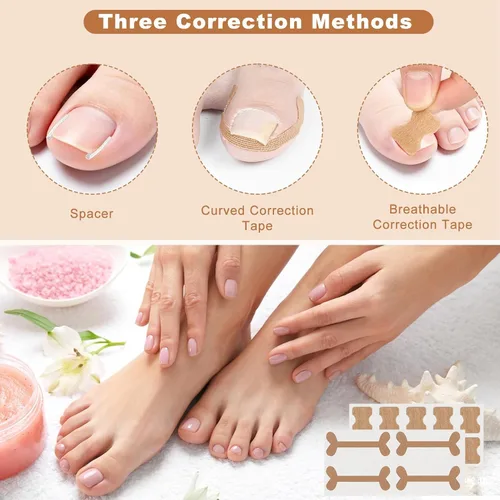 Vista 4 de Juego de corrector de uñas encarnadas con tiras correctoras – Kit de herramientas profesionales para uñas de los pies que incluye tiras