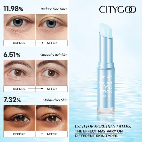 Vista 4 de CITYGOO - Barra de ojos con retinol y colágeno, con ácido hialurónico para ojeras, crema antienvejecimiento para debajo de los ojos, para reducir