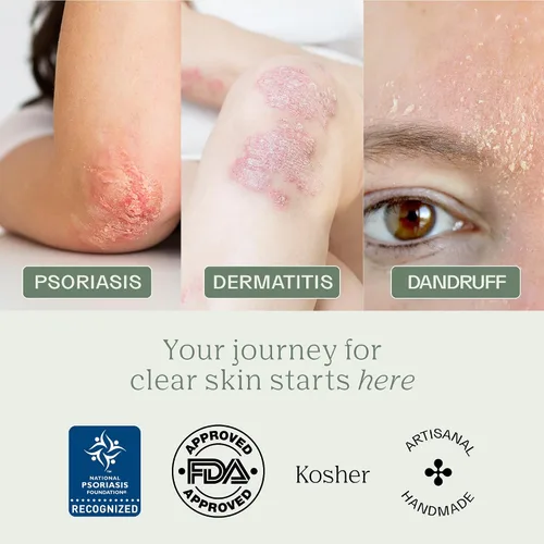 Vista 7 de Barra de jabón Dermabon para el control de la psoriasis, dermatitis y caspa con 2% de alquitrán de hulla como ingrediente activo - 1 paquete Jabón