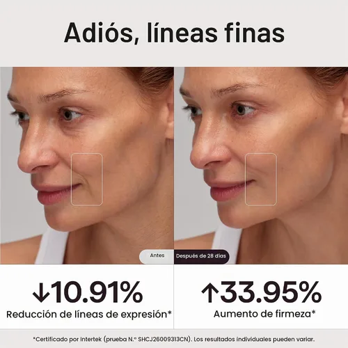 Vista 7 de Wavytalk Esculpir el dispositivo facial de la microcorriente del tiempo Oro champán