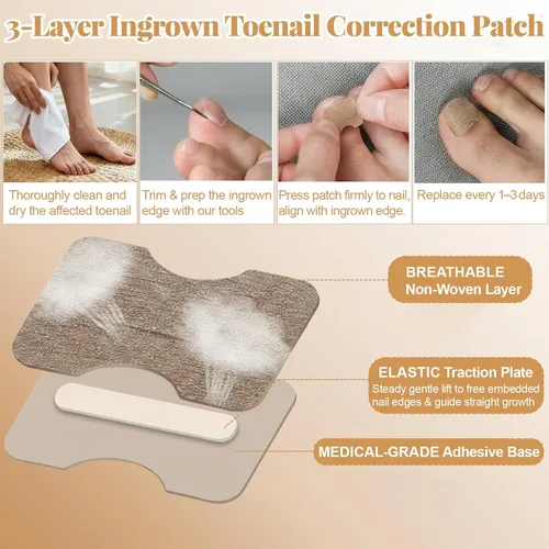 Vista 4 de Kit de eliminación y corrector de uñas encarnadas para un alivio rápido del dolor, kit profesional de tratamiento de uñas encarnadas con tiras