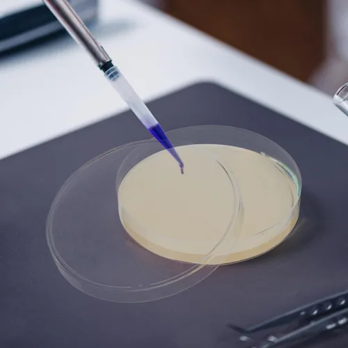Vista 9 de ULTECHNOVO Platos de agar de dextrosa de patata, platos de agar de dextrosa prevertida PDA Petri - Excelente medio de crecimiento - Proyectos