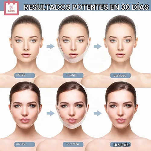 Vista 3 de Reductor de barbilla doble, eliminador de barbilla doble, línea V, máscara de elevación para barbilla, correa de barbilla para mujer, correa