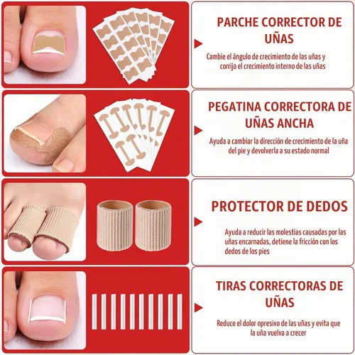 Vista 5 de Kit de eliminación de uñas encarnadas, kit de herramientas de uñas encarnadas con corrector de uñas encarnadas, gotas de uñas encarnadas, parche