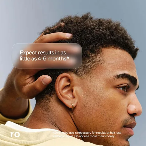 Vista 4 de RO MAN Minoxidil Solución al 5% para la pérdida y el crecimiento del cabello de los hombres, líquido sin perfume, clínicamente probado, 2 onzas