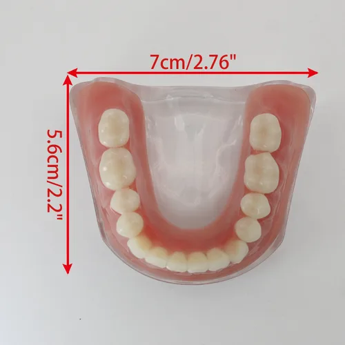 Vista 7 de Color dorado dental del diente inferior de la sobredentadura del implante de la precisión 4 modelo de los dientes