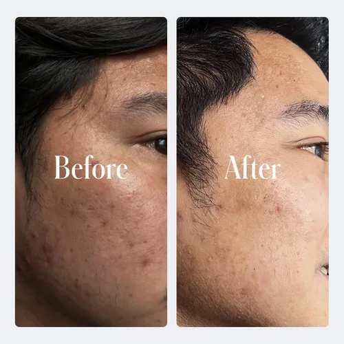 Vista 7 de Geologie Crema facial antienvejecimiento con retinol Fórmula mejorada de retinol de 0.2% para resultados eficaces Reduce líneas finas y arrugas