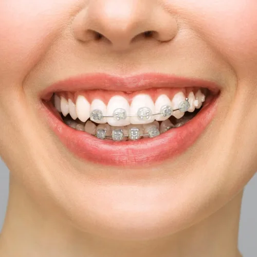 Vista 7 de BVN Cera dental: 10 cajas de tiras de cera de ortodoncia, cera de frenillos para dientes, cera ortográfica para aparatos ortopédicos, cera dental