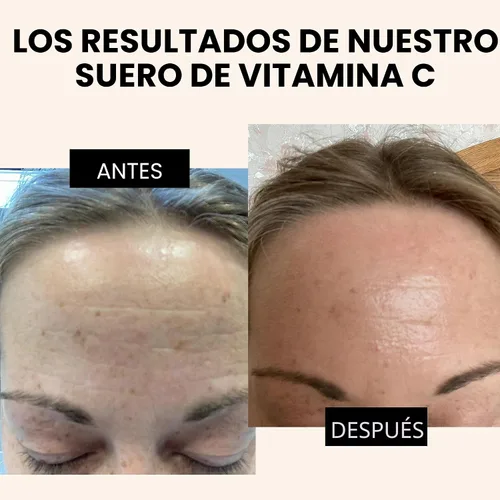 Vista 4 de Suero facial con vitamina C, ácido hialurónico, ácido ferúlico y vitamina E, suero iluminador facial antienvejecimiento para el cuidado de la piel