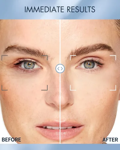 Vista 4 de depology Repone y repara parches debajo de los ojos para ojos hinchados, arrugas (60 parches) Hidratación con ceramidas y ácido hialurónico