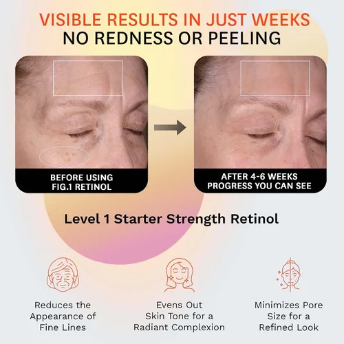 Vista 2 de Fig.1 Crema de noche Retinol Hidratante facial con retinol y escualano Crema de noche para mujeres con piel sensible Reducción de arrugas