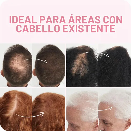 Vista 4 de BOLDIFY Fibras capilares para cabello fino, para mujeres y hombres, marrón Marrón cenizo