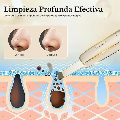 Vista 3 de Herramientas para quitar puntos negros, espátula facial 4 en 1 para Dorado
