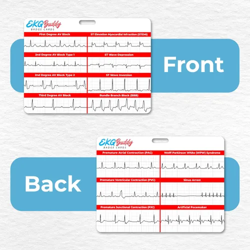 Vista 4 de Set de 5 tarjetas de interpretación de ECG de EKG Buddy - Tarjetas de ECG para enfermeras doble cara, guía de ritmo, hoja de trampa de ECG, tiras