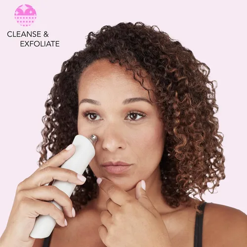 Vista 6 de skn by Conair - Herramienta facial de microdermabrasión, aspiradora de poros, elimina las células muertas de la piel y la suciedad de los poros