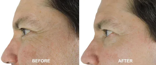 Vista 2 de DNA CODE® - Aceite de argán orgánico de día/noche Wrinke Reduce Cream, w/Argireline, M3000, Célula de tallo de manzana, ácido hialurónico