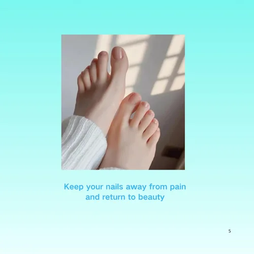 Vista 5 de Juego de corrector de uñas encarnadas con parche de corrección de uñas curvas, kit de eliminación de uñas mejorado, herramientas de pedicura