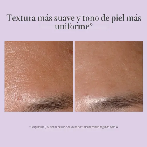 Vista 5 de EXUVIANCE Performance Peel AP25, At-Home Chemical Peel with Glycolic Acid, Gently Refines Pores, Anti-Aging Peel, Treats Fine Lines, Wrinkles &