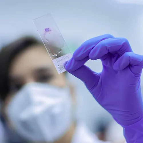 Vista 7 de Paquete de 100 diapositivas para microscopio de laboratorio, diapositivas de vidrio de 1mm-1.2mm de espesor para microscopio, bordes de vidrio