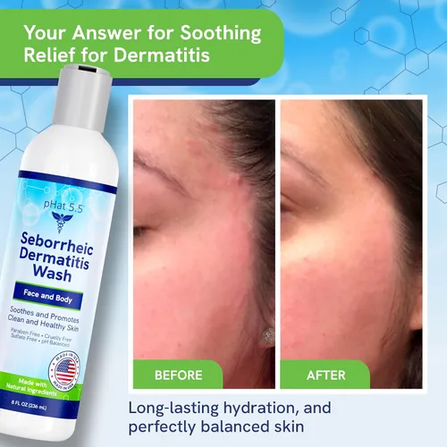 Vista 6 de Jabón facial suave con miel de manuka, limpiador facial natural y orgánico y gel de baño para pieles sensibles, hipoalergénico, sin parabenos y sin