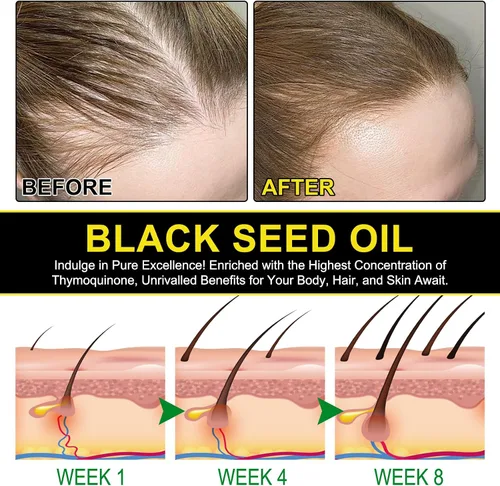 Vista 7 de Aceite de semilla negra – Aceite de semilla negra 100% virgen prensado en frío de alta calidad, antioxidante Omega 3 6 9, refuerzo inmunológico