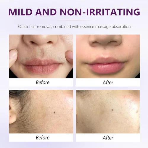 Vista 5 de Crema depilatoria facial para mujeres, kit de cremas depilatorias faciales suaves con raspado, suero calmante, crema removedor de vello corporal