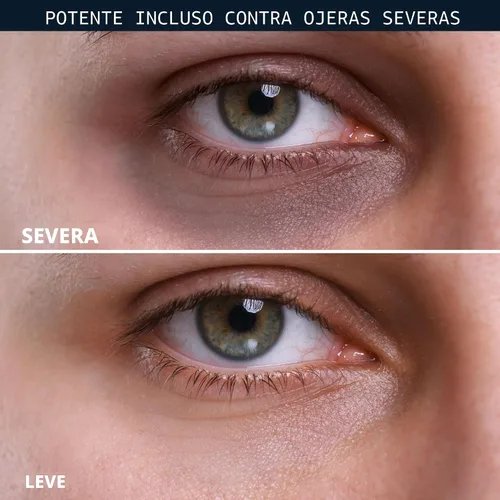 Vista 4 de RoC Derm Correxion Retinol Crema de Reparación para Ojos Tratamiento de Ojeras con Niacinamida, Resveratrol, Proxygen para ojos hinchados, arrugas