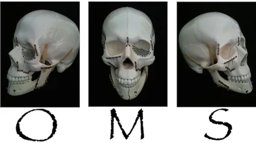 Vista 3 de CafePress OMS - Taza quirúrgica con diseño de calavera de 11 oz (11.0 fl oz)