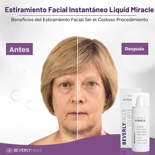 Vista 4 de Beverly Hills Tratamiento de suero de ojos antienvejecimiento instantáneo para ojeras, ojos hinchados, arrugas, bolsas debajo de los ojos, líneas