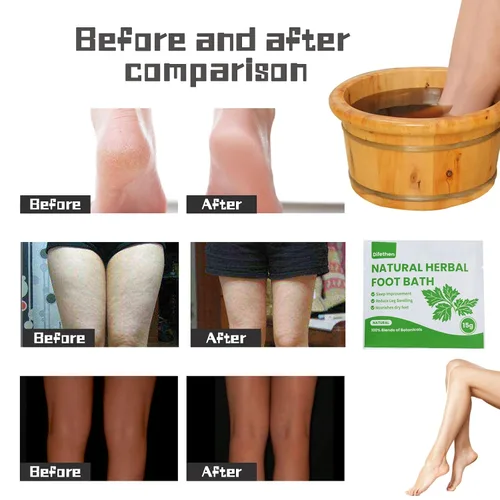Vista 5 de Remojo natural para pies de artemisa/ajenjo, bolsa de baño de pies de jengibre linfático, spa para pies antihinchazón que promueve el metabolismo