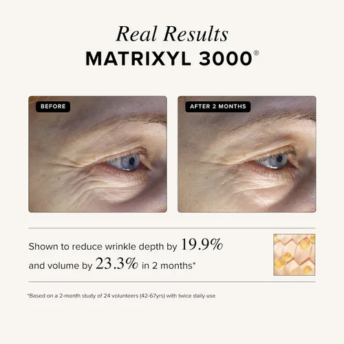 Vista 5 de Asterwood Triple Repair Matrixyl 3000 + Argireline + ácido hialurónico + suero de vitamina C para cara, antienvejecimiento, estimulante de colágeno