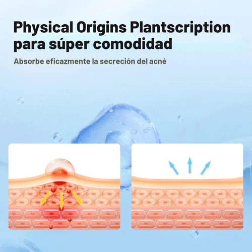 Vista 5 de QUSTERE Parches para espinillas para la cara, parches hidrocoloides para el acné, lindas cubiertas de espinillas con forma de estrella, pegatinas