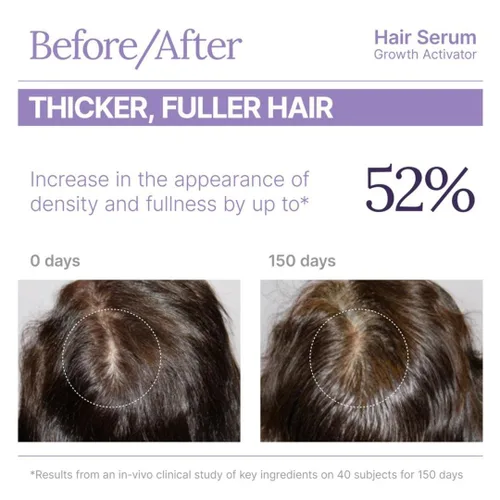 Vista 6 de Keranique Suero activador del crecimiento del cabello para mujeres, revitalizador multipéptido del cuero cabelludo para adelgazamiento del cabello