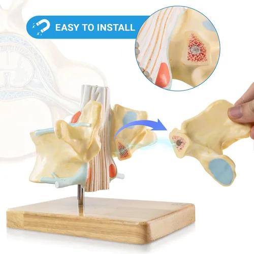 Vista 3 de EVOTECH SCIENTIFIC Modelo de vértebra lumbar humana agrandada con médula espinal y equina cauda – 2 veces 2 piezas modelo de columna vertebral