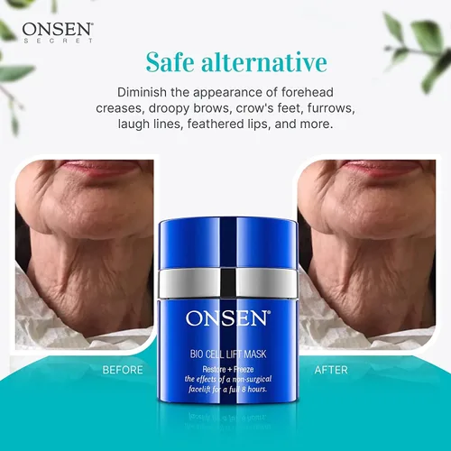 Vista 4 de Onsen - Rejuvenecimiento facial antiarrugas no invasivo, suaviza las arrugas, repara la piel, máscara secreta de grado profesional para el cuidado