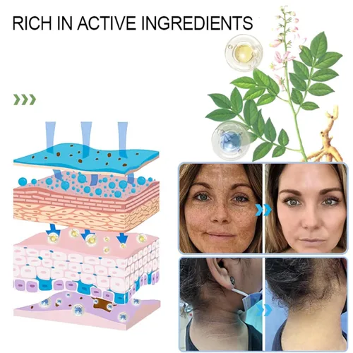 Vista 4 de Gel exfoliante purificador, limpiador facial y exfoliante de limpieza profunda para rostro y cuerpo, hidratante limpia la piel y limpia la suciedad