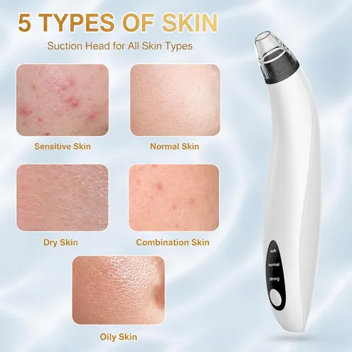 Vista 11 de Blackhead Remover Tools,Electric Vacuum Facial Pore Cleaner Tool(White)