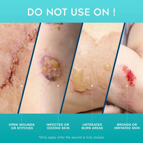 Vista 7 de Aroamas Scar Gel avanzado para cicatrices, gel de silicona de grado médico para ayudar a mejorar la apariencia de cicatrices y estrías para rostro